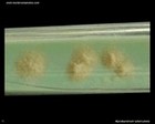 Mycobacterium tuberculosis